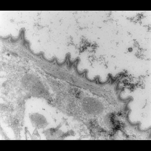 Vorticella convallaria cortical myoneme in a thin cryosection labeled with anti-alpha-centrin and gold-conjugated anti-rabbit IgG. The source interprets gold at the myoneme as centrin localization. TEM acquired by D. Kunkel on 1994-08-18; unmodified source-served preview, not a calibrated measurement.