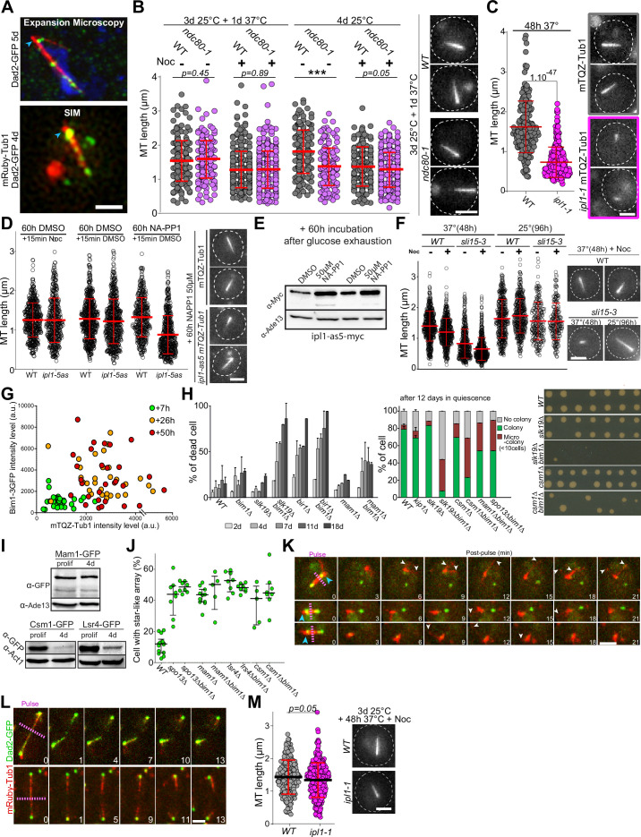 Multipanel figure: A shows tubulin and Dad2 with expansion microscopy and SIM (1 micrometer bars); K follows quiescent bundles after laser severing (2 micrometer bar). L is a proliferating-cell anaphase-spindle control, not a quiescent bundle. Other panels combine perturbation imaging, morphometry, immunoblots and survival assays. Nonspecific cytoplasmic yellow background in A is not GFP localization.