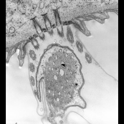 Vorticella convallaria spasmoneme profile with membrane-bounded tubules and adjacent cortical structures. Unmodified source-served TEM preview by Richard Allen. This image shows morphology, not protein-specific localization or a calcium-transport measurement; no calibrated dimensions are inferred from the preview.