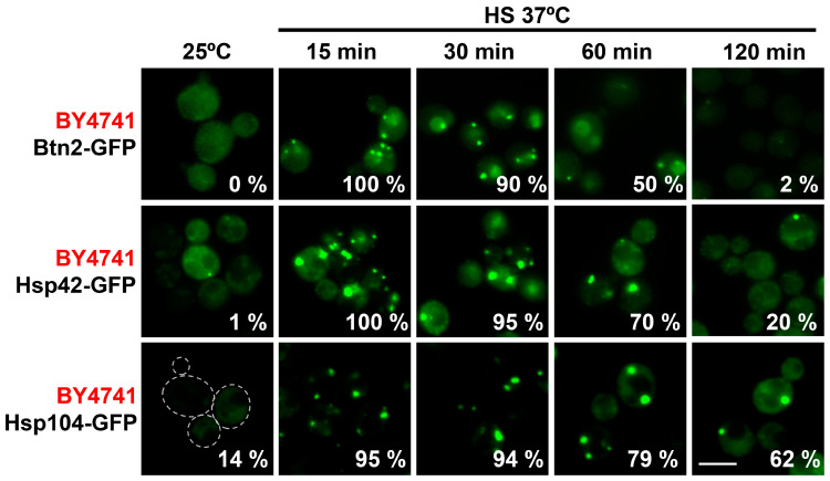 Figure 2. GFP-tagged Hsp42, Hsp104 and Btn2 form heat-induced foci in BY4741-derived budding yeast at 37 C. Rows compare the tagged chaperones over time; dashed outlines mark cells and scale bars are 5 micrometers. Hsp104 is a disaggregase, not a small heat shock protein. Separate single-label images do not establish simultaneous three-way colocalization.