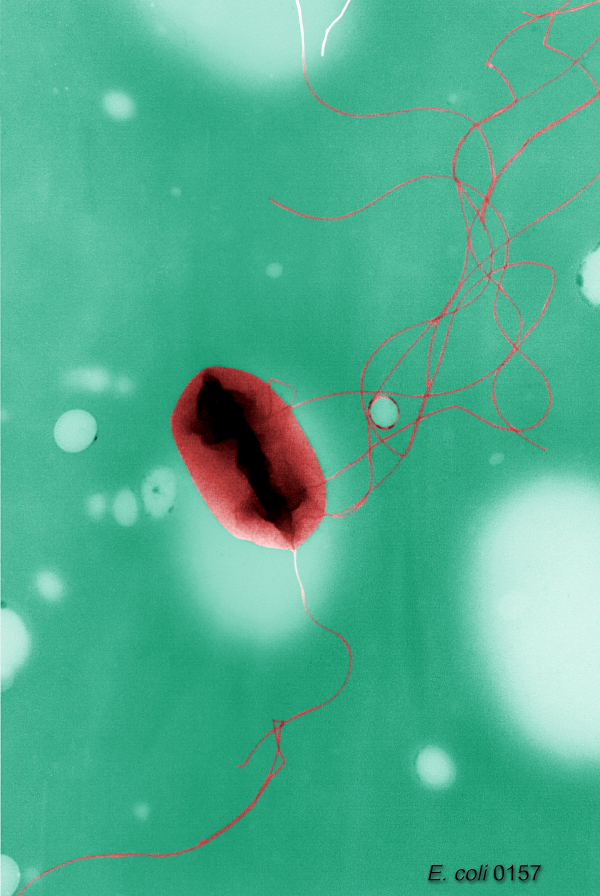 Transmission electron micrograph (pseudoreplica technique) of an Escherichia coli O157:H7 cell with peritrichous flagella.