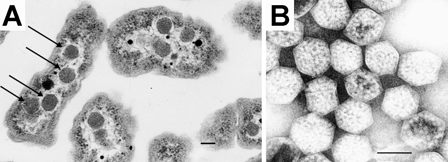Thin-section electron micrograph of Halothiobacillus neapolitanus cells containing carboxysomes, and negatively stained isolated carboxysomes. Scale bars 100 nm.
